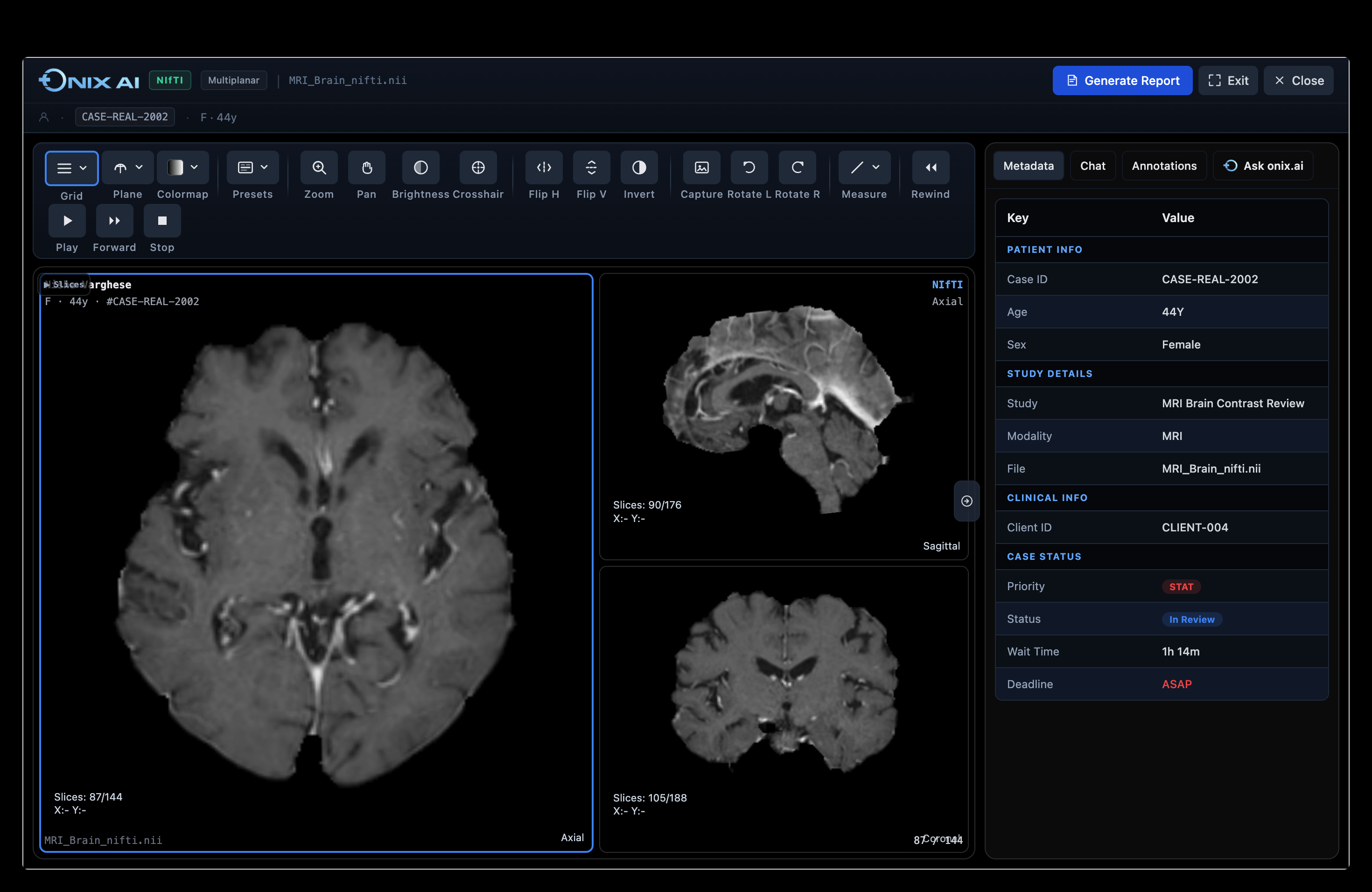 ONIX AI Organization Dashboard